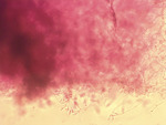 MISSING THUMBNAIL